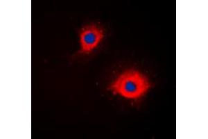 Immunofluorescence (IF) image for anti-Tumor Necrosis Factor (Ligand) Superfamily, Member 11 (TNFSF11) (Center) antibody (ABIN7301382)