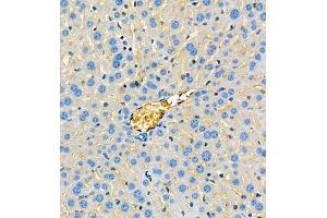 Immunohistochemistry of paraffin embedded mouse liver using ApoA2 (ABIN7073083) at dilution of 1:650 (300x lens) (APOA2 抗体)