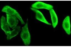 Detection of GAPDH in HepG2 cells using Polyclonal Antibody to Glyceraldehyde-3-Phosphate Dehydrogenase (GAPDH) (GAPDH 抗体  (AA 154-324))