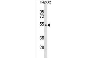 TPE Antibody (Center) (ABIN1537828 and ABIN2838253) western blot analysis in HepG2 cell line lysates (35 μg/lane). (TMPPE 抗体  (AA 133-161))