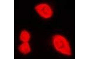 Immunofluorescent analysis of DDX3X (pT322) staining in HeLa cells. (DDX3X 抗体  (pSer322))