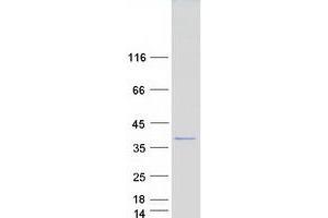 Western Blotting (WB) image for Sodium Channel Modifier 1 (SCNM1) protein (Myc-DYKDDDDK Tag) (ABIN2731496)