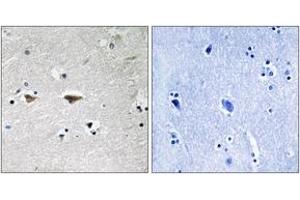 Immunohistochemistry (IHC) image for anti-Proto-oncogene tyrosine-protein kinase Src (Src) (AA 41-90) antibody (ABIN2889119) (Src 抗体  (AA 41-90))