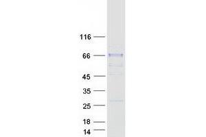 Western Blotting (WB) image for Sialic Acid Acetylesterase (SIAE) protein (Myc-DYKDDDDK Tag) (ABIN2732022)