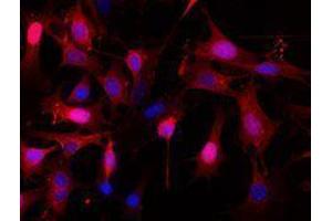 Immunofluorescence (IF) image for anti-Epithelial Cell Adhesion Molecule (EPCAM) antibody (Alexa Fluor 594) (ABIN2656829) (EpCAM 抗体  (Alexa Fluor 594))