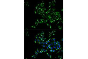 Immunofluorescence analysis of HeLa cell using TNFSF11 antibody. (RANKL 抗体  (AA 78-317))