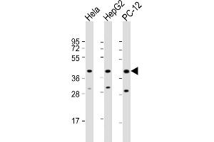 All lanes : Anti-PK14 Antibody  at 1:2000 dilution Lane 1: Hela whole cell lysate Lane 2: HepG2 whole cell lysate Lane 3: PC-12 whole cell lysate Lysates/proteins at 20 μg per lane. (MAPK14 抗体  (AA 301-330))