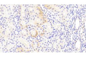 Immunohistochemistry (IHC) image for anti-Solute Carrier Family 1 (Neuronal/epithelial High Affinity Glutamate Transporter, System Xag), Member 1 (SLC1A1) (AA 115-209) antibody (ABIN7441163)