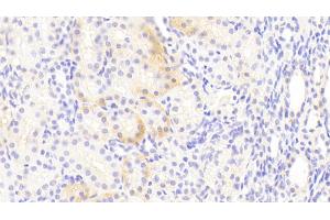 Detection of EAAT3 in Human Kidney Tissue using Polyclonal Antibody to Excitatory Amino Acid Transporter 3 (EAAT3) (SLC1A1 抗体  (AA 115-209))