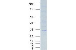 Western Blotting (WB) image for NK3 Homeobox 1 (NKX3-1) protein (Myc-DYKDDDDK Tag) (ABIN2727377)