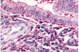 Anti-TBXA2R antibody  ABIN1049407 IHC staining of human uterus.