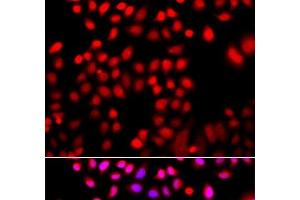 Immunofluorescence analysis of A549 cells using CFL2 Polyclonal Antibody (Cofilin 2 抗体)