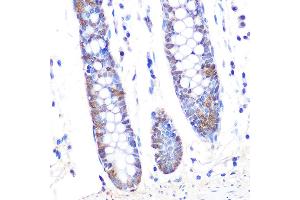 Immunohistochemistry of paraffin-embedded human colon using Thioredoxin 1 (Trx1/TXN) Rabbit mAb (ABIN1679926, ABIN3018425, ABIN3018426 and ABIN7101611) at dilution of 1:100 (40x lens). (TXN 抗体)