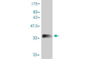 Western Blot detection against Immunogen (39. (SAA1 抗体  (AA 1-122))