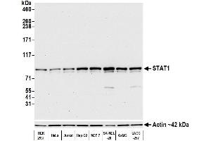 Western Blotting (WB) image for anti-Signal Transducer and Activator of Transcription 1, 91kDa (STAT1) (AA 400-450) antibody (ABIN7452583)