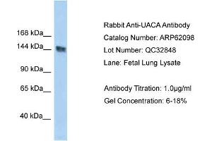Western Blotting (WB) image for anti-UACA (UACA) (C-Term) antibody (ABIN2774333) (UACA 抗体  (C-Term))