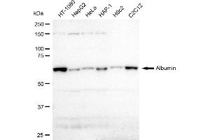 Western blotting analysis using Albumin antibody (ABIN7797549).