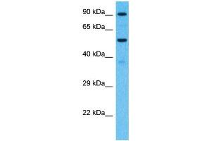Host:  Rabbit  Target Name:  PCDHB7  Sample Type:  Fetal Kidney lysates  Antibody Dilution:  1. (PCDHb7 抗体  (Middle Region))