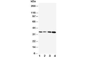 Western blot testing of Protein C antibody and Lane 1:  Jurkat;  2: CEM;  3: SMMC-7721;  4: HeLa cell lysate. (PROC 抗体  (AA 446-461))