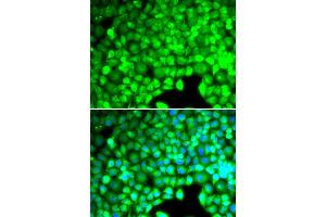 Immunofluorescence analysis of U20S cell using CYTH2 antibody. (Cytohesin 2 抗体)