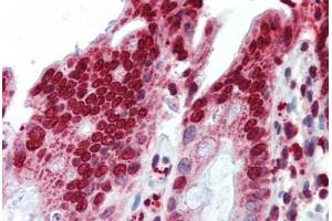 Human Colon (formalin-fixed, paraffin-embedded) stained with BXDC5 antibody ABIN462228 followed by biotinylated goat anti-rabbit IgG secondary antibody ABIN481713, alkaline phosphatase-streptavidin and chromogen. (RPF1 抗体  (AA 45-94))
