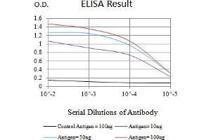 Black line: Control Antigen (100 ng),Purple line: Antigen (10 ng), Blue line: Antigen (50 ng), Red line:Antigen (100 ng)