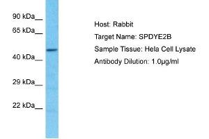 Host: Rabbit Target Name: SPDYE2B Sample Type: Hela Whole Cell lysates Antibody Dilution: 1. (SPDYE2B 抗体  (N-Term))