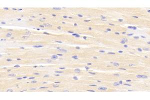 Detection of ERRb in Mouse Cardiac Muscle Tissue using Polyclonal Antibody to Estrogen Related Receptor Beta (ERRb) (ESRRB 抗体  (AA 166-438))