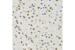 Immunohistochemistry of paraffin-embedded rat brain using SPIN1 antibody (ABIN2560112) at dilution of 1:100 (40x lens). (Spindlin 1 抗体)