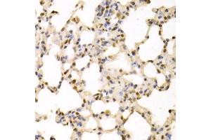 Immunohistochemistry of paraffin-embedded rat lung using SFN Antibody. (14-3-3 sigma/SFN 抗体  (AA 1-248))