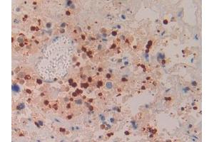 Immunohistochemistry (IHC) image for anti-Azurocidin 1 (AZU1) (AA 23-247) antibody (ABIN7433654)