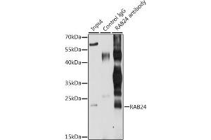 Immunoprecipitation analysis of 200 μg extracts of MCF-7 cells, using 3 μg R antibody (ABIN6132225, ABIN6146561, ABIN6146562 and ABIN6224440). (RAB24 抗体  (AA 1-203))