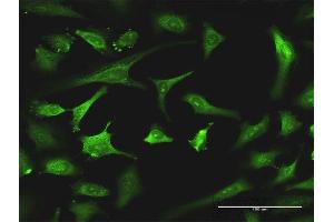 Immunofluorescence of monoclonal antibody to EXOSC8 on HeLa cell. (EXOSC8 抗体  (AA 177-276))