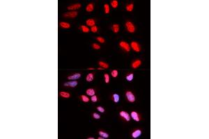 Immunofluorescence analysis of U2OS cells using PRPF3 antibody (ABIN5973192). (PRPF3 抗体)