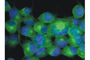 Immunofluorescence staining (mouse neuroblastoma cells) Immunofluorescence staining of Neuro2a mouse neuroblastoma cell line using anti-betaIII-tubulin (TU-20 ; green; 3 μg/ml). (TUBB3 抗体  (N-Term) (FITC))
