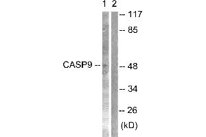 Immunohistochemical analysis of paraffin-embedded human lung carcinoma tissue using Caspase 9 (Ab-125) antibodyWestern blot analysis of extracts from NIH/3T3 cells treated with TNF-α (20ng/ml, 30min), using Caspase 9 (Ab-125) antibody (Caspase 9 抗体)