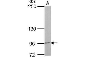 WB Image Sample (30 ug of whole cell lysate) A: NIH-3T3 5% SDS PAGE antibody diluted at 1:1000 (Insulin Receptor 抗体  (C-Term))