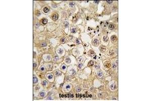 Formalin-fixed and paraffin-embedded human testis tissue reacted with ACE2 (SARS Receptor) Antibody (C-term) f , which was peroxidase-conjugated to the secondary antibody, followed by DAB staining. (ACE2 抗体  (C-Term))