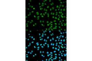 Immunofluorescence analysis of HeLa cells using CST8 antibody.