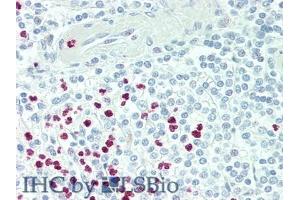 Immunohistochemistry (IHC) image for anti-Peptidyl Arginine Deiminase, Type IV (PADI4) (AA 1-300) antibody (ABIN7436108)