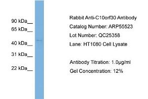 WB Suggested Anti-C10orf30  Antibody Titration: 0. (BEND7 抗体  (N-Term))