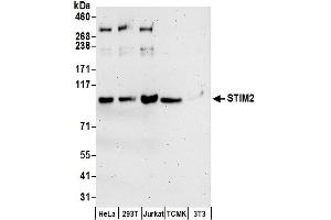anti-Stromal Interaction Molecule 2 (Stim2) (AA 600-650) antibody