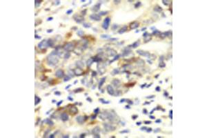 Immunohistochemistry of paraffin-embedded human colon carcinoma using APLP1 antibody (ABIN1871026) at dilution of 1:100 (40x lens). (APLP1 抗体)