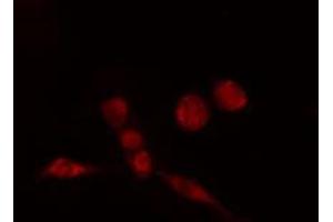 ABIN6274184 staining HeLa cells by IF/ICC. (AFT7 抗体  (N-Term))