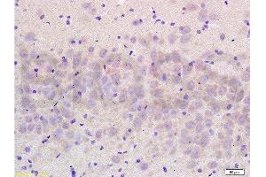Immunohistochemistry (Paraffin-embedded Sections) (IHC (p)) image for anti-Solute Carrier Family 8 (Sodium/calcium Exchanger), Member 2 (SLC8A2) (AA 601-700) antibody (ABIN676478)