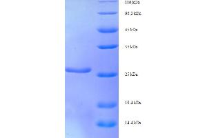 XRCC5 Protein (AA 251-455, partial) (His tag)