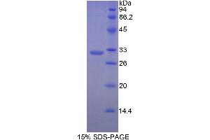 SDS-PAGE analysis of Human MYH7 Protein. (MYH7 蛋白)