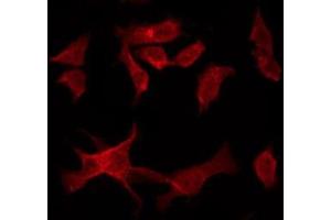 ABIN6277126 staining HuvEc by IF/ICC. (MALT1 抗体  (Internal Region))