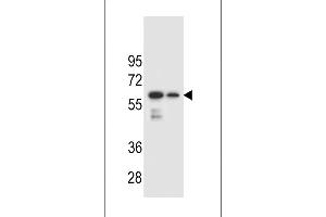 CHST3 Antibody (N-term) (ABIN654418 and ABIN2844154) western blot analysis in mouse spleen and lung tissue lysates (35 μg/lane). (CHST3 抗体  (N-Term))