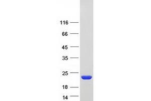 Western Blotting (WB) image for Non-Metastatic Cells 1, Protein (NM23A) Expressed in (NME1) (Transcript Variant 2) protein (Myc-DYKDDDDK Tag) (ABIN2726965)